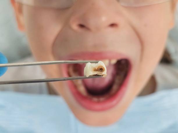 Best Emergency Treatment for Oral Infections in Jonestown, TX